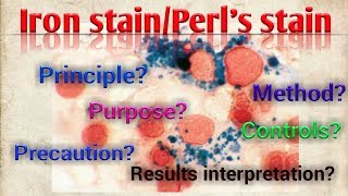 Perls stainIron stainPrussian Blue ReactionHematologySpecial stainSTAR LABORATORY [upl. by Carlotta]