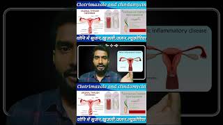 clotrimazole and clindamycin  cansoftcl  candidcl  vaginalinfection  shortvideo  viral [upl. by Swart]