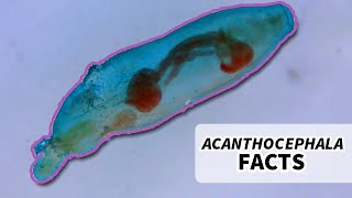 Acanthocephala Facts the Thorny Headed Worm  Animal Fact Files [upl. by Ettedo327]