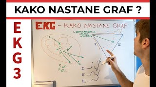 EKG 3  Kako nastane graf [upl. by Luaped]