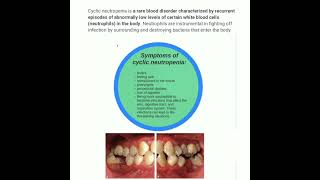 👒 Cyclic neutropenia 👒 [upl. by Helene939]