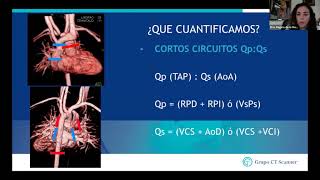 Actualidades en la Imagenlogía cardiaca [upl. by Aihsik]