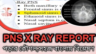 পিএনএস এক্স রে রিপোর্টx ray pns om view bangla [upl. by Kristy185]