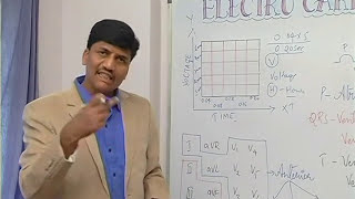 ಶಶಿ ಇಸಿಜಿ ಕನ್ನಡ ಭಾಗ  1 Shashis ECG in Kannada  Part 1 [upl. by Sremlahc]