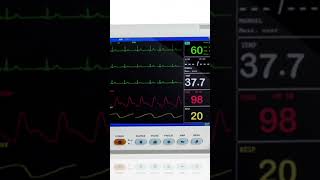 My Heart Monitor [upl. by Sabir]