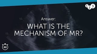 60 Seconds of Echo Teaching Answer What is the mechanism of MR [upl. by Norrv]