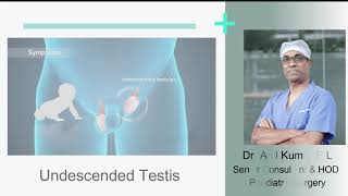 Undescended Testis Cryptorchidism  Sakra World Hospital [upl. by Aneeles]