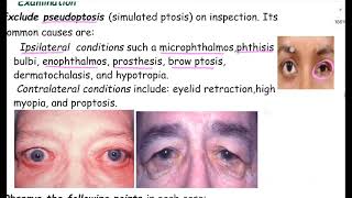 Ptosis lectureComprehensive Ophthalmology lecture A K Khurana [upl. by Oilenroc128]