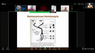 Fellowship Class by MK Sastry 10112024 Neuroplasticity and Stroke Management [upl. by Nyliac]