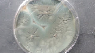 penicillium growth on SDA [upl. by Aliahkim]