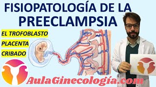 FISIOPATOLOGÍA DE LA PREECLAMPSIA DESARROLLO de la PLACENTA ANORMAL Ginecología y Obstetricia [upl. by Behah]