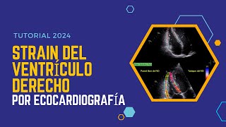 ✅STRAIN DEL VENTRÍCULO DERECHO por ecocardiografía 🥈Tutorial 2024 [upl. by Sessilu968]