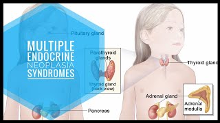 Multiple Endocrine Neoplasia  Rapid Review [upl. by Baal]