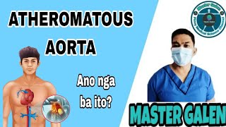 Ano ang Atheromatous Aorta [upl. by Elmaleh]