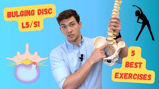 Bulging Disc L5S1 The 5 Best Exercises Explained in Detail [upl. by Ahsilak]