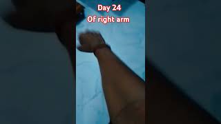 Day 24 of right arm exercise armexercises youtubeshorts [upl. by Ayaet]