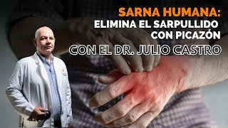 ¿Cuáles son los síntomas de la sarna humana II Parte Médico con Julio Castro [upl. by Neit693]