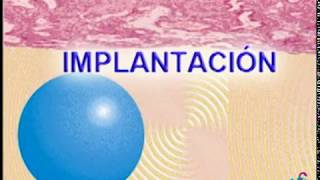 implantacion [upl. by Georgine]