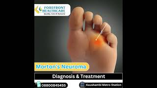 Morton’s neuroma diagnosis and treatment in kaushambi metro station Ghaziabad mortonsneuroma [upl. by Bertrand]