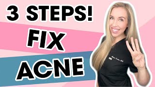 3 Steps To Fix Your Acne WITHOUT A Prescription  Skincare Made Simple by The Budget Dermatologist [upl. by Adnaluoy]