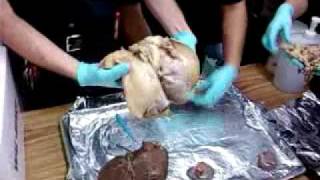 Medical Terminology Human Organ Demonstration [upl. by Giselbert]