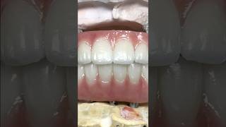 Fantastic Monolithic Zirconia Implants lsk121shorts dentist dentistteeth [upl. by Hanyaz]