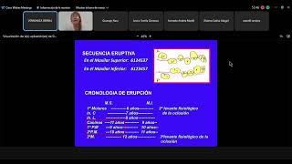 Caracteristicas de la Denticion Mixta y Permantenete [upl. by Keyte907]