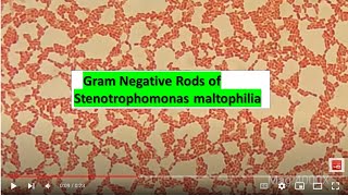 Gram Negative Rods of Stenotrophomonas maltophilia at various magnifications 1000X 2000X4000X [upl. by Gittel]