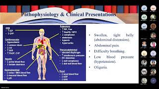 compartment syndrome abdominal [upl. by Lowson]