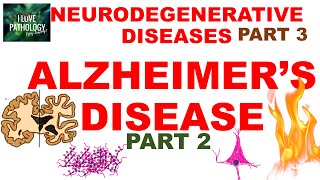 NEURODEGENERATIVE DISEASES PART 3 ALZHEIMER DISEASE Morphology Clinical Features amp Treatment [upl. by Emsmus]