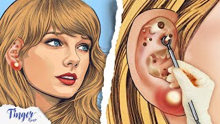 ASMR Animation Removing of Ear Blackhead Ear Swelling And Sebaceous Cyst From Taylor Swifts Ear [upl. by Carr]