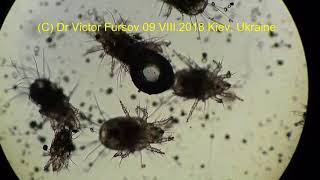 Terrible Mites Under Microscope Live Mites Acarus siro X 100 ENGLISH Story [upl. by Aihsyak679]