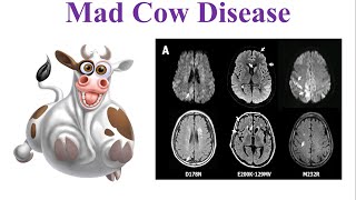 What is Mad Cow Disease  Bovine Spongiform Encephalopathy  BSE  vCJD  How Prion Kills [upl. by Atonsah]