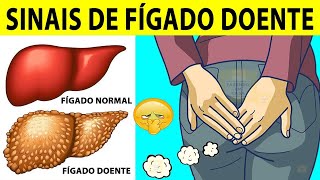 10 Sinais de FÍGADO Doente [upl. by Grossman375]