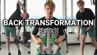 How I Transformed my Back After Injury [upl. by Yhtnomit315]