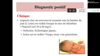 ICTERES NEONATAUX Dr DJEGHALI [upl. by Chee]