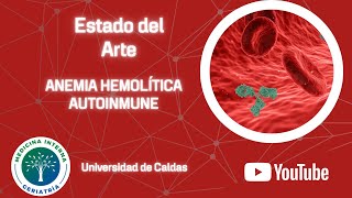 Anemia hemolítica autoinmune [upl. by Humfrid]