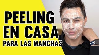 HAZ ESTO UNA VEZ A LA SEMANA PARA QUITAR LAS MANCHAS DE LA CARA Y EL ACNE 2019 [upl. by Ev289]