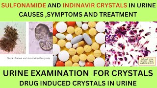 SULFONAMIDE AND INDINAVIR CRYSTALS IN URINECAUSES SYMPTOMS AND TREATMENT OF SULFONAMIDE CRYSTALS [upl. by Nannette]