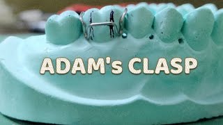 Fabrication of Adams clasp  DENTORAL GURU dentist orthodontist dentaleducation [upl. by Ailadi]