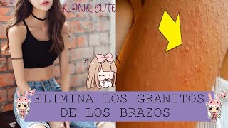 COMO ELIMINAR LOS GRANITOS DE LOS BRAZOS 💜 [upl. by Ahseenak]