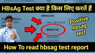 Hbsag Positive  hbsag test  hbsag test in hindi  hbsag test report  hepatitis b test results [upl. by Baggs]