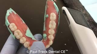 Scanning Radiopaque PVS Relined Denture with TRIOS amp Guide Workflow [upl. by Hieronymus]