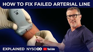 HOW TO FIX FAILED ARTERIAL LINE [upl. by Nero459]