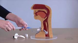 Tracheostomy  Respiratory phonatory and swallowing function  TRACS WA [upl. by Howarth]