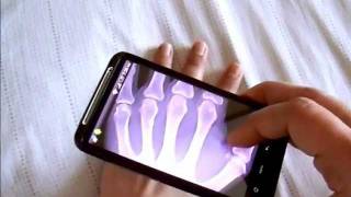 XRay Scanner Pro free app for Android [upl. by Gisela]