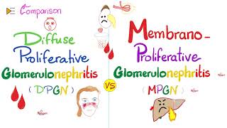 Diffuse Proliferative Glomerulonephritis vs Membranoproliferative Glomerulonephritis  DPGN vs MPGN [upl. by Nanete]