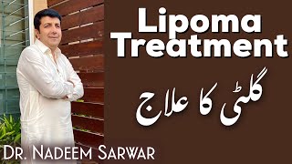 Lipoma Treatment Lipoma Ka ilaaj  Homeopathic by H Dr M Nadeem Sarwar ENG subs [upl. by Jessalin349]