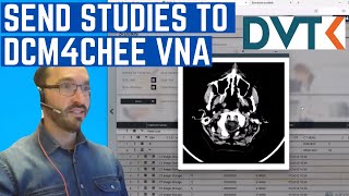 How to Send DICOM Studies with DVTK Storage SCU Emulator to dcm4chee VNA [upl. by Schild619]