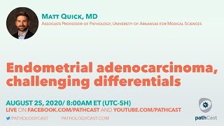 Endometrial adenocarcinoma challenging differentials  Dr Quick UAMS GYNPATH [upl. by Fanestil]